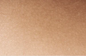 Slightly dehydrated but normal skin