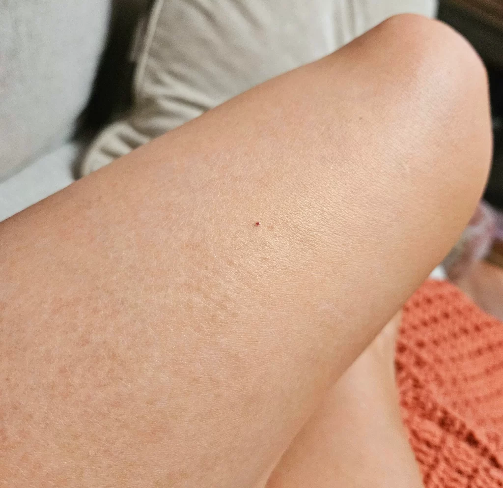 Legs after not using everything for 10 days